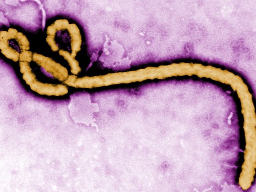 Ebola virus disease in DRC