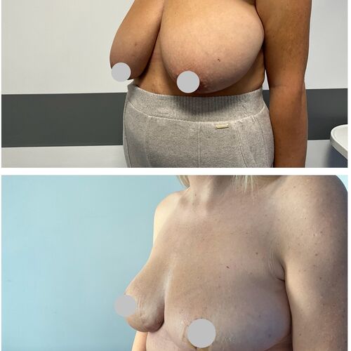 Gallery | FM Plastic Surgery Ltd  | Plastic Surgeon Newcastle | Cosmetic Surgery Newcastle | Skin and Hand Surgery North East