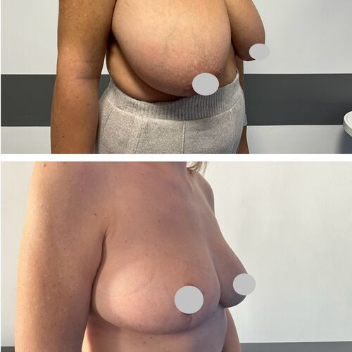 Gallery | FM Plastic Surgery Ltd  | Plastic Surgeon Newcastle | Cosmetic Surgery Newcastle | Skin and Hand Surgery North East