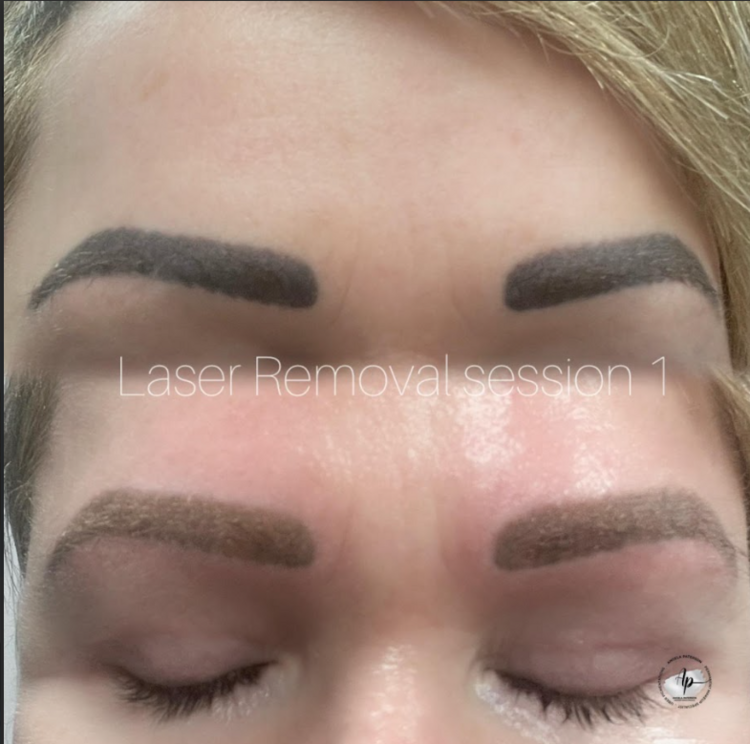 Services | Uber Pigmentations  | Lip blush tattoo ayrshire | Microblading brow tattoo ayrshire | Eyeliner tattoo specialist ayrshire