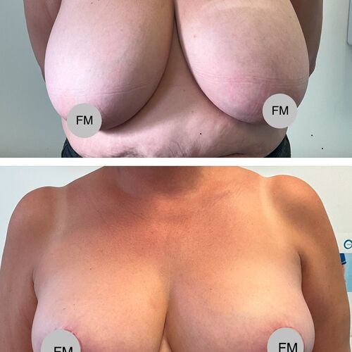 Gallery | FM Plastic Surgery Ltd  | Plastic Surgeon Newcastle | Cosmetic Surgery Newcastle | Skin and Hand Surgery North East
