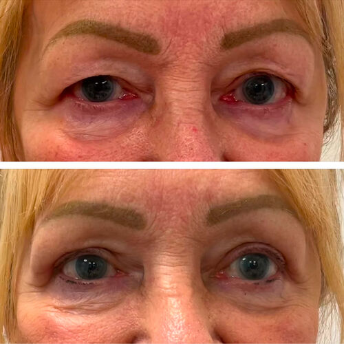 Gallery | FM Plastic Surgery Ltd  | Plastic Surgeon Newcastle | Cosmetic Surgery Newcastle | Skin and Hand Surgery North East