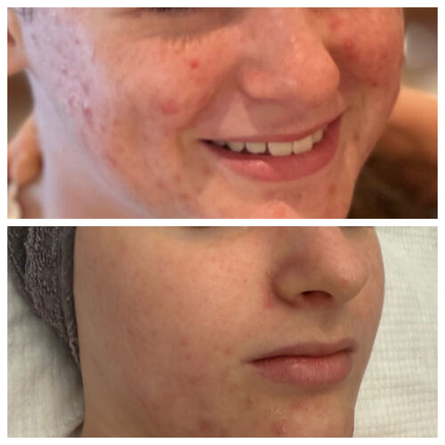 Gallery | Creations Skincare Centre Ltd | Dermalogica Derby | Elemis Derby | Beauty Salon Mickleover