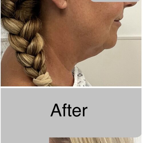 Gallery | FM Plastic Surgery Ltd  | Plastic Surgeon Newcastle | Cosmetic Surgery Newcastle | Skin and Hand Surgery North East