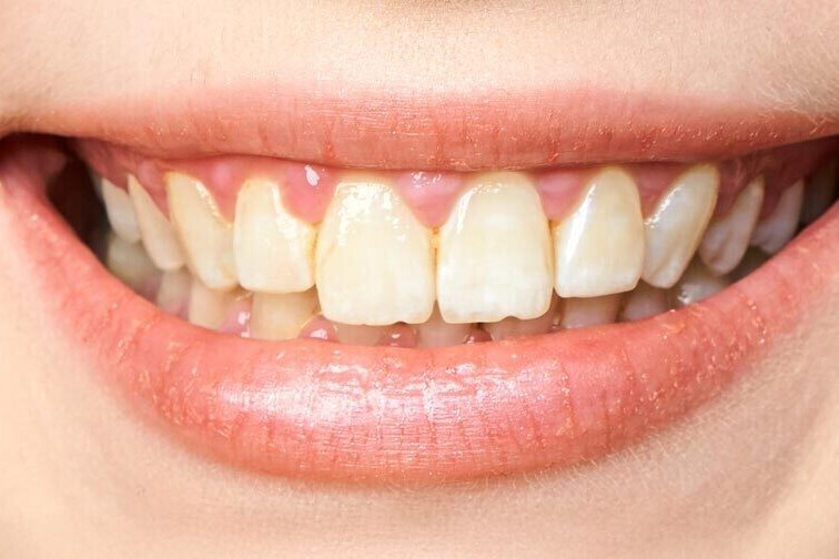 Results | K&amp;S Smiles