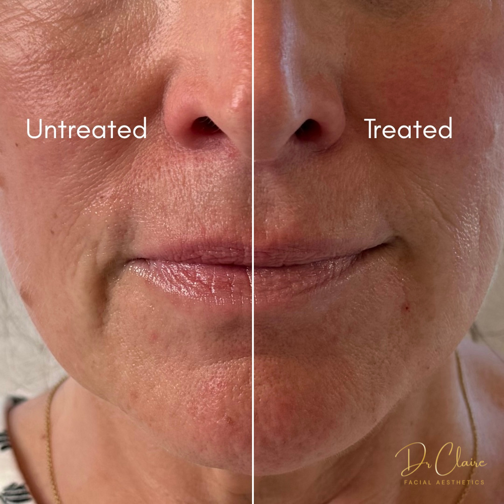 Transformations | Dr Claire Facial Aesthetics | Botox Chorley | Fillers Chorley | Aesthetics Chorley | Botox Treatments Chorley | Dermal Fillers Chorley | Aesthetic Enhancements Chorley