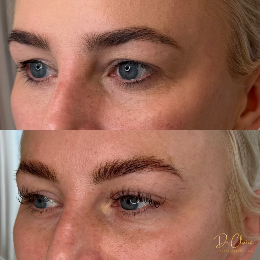 Transformations | Dr Claire Facial Aesthetics | Botox Chorley | Fillers Chorley | Aesthetics Chorley | Botox Treatments Chorley | Dermal Fillers Chorley | Aesthetic Enhancements Chorley
