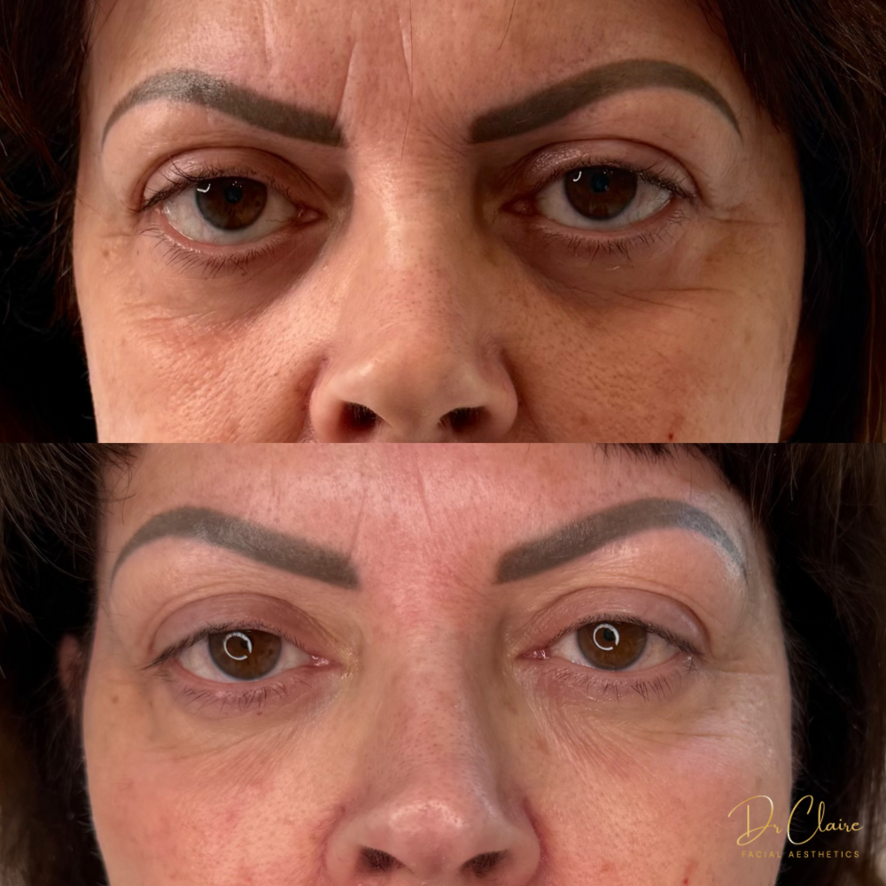 Transformations | Dr Claire Facial Aesthetics | Botox Chorley | Fillers Chorley | Aesthetics Chorley | Botox Treatments Chorley | Dermal Fillers Chorley | Aesthetic Enhancements Chorley