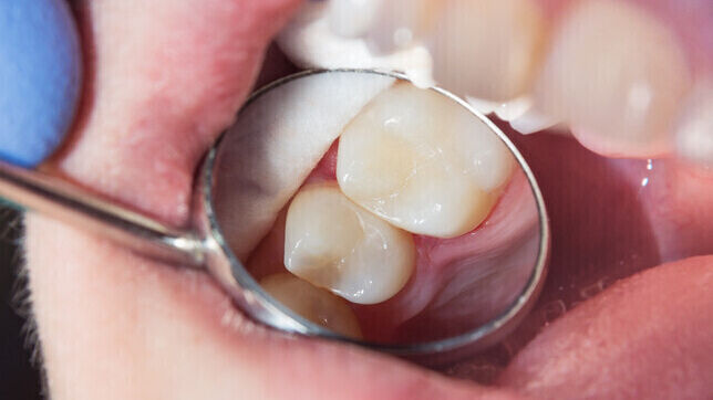 Advanced Dentistry | Cramond House Dental Practice | Dentist Clitheroe Preston Manchester | Dental Implants Clitheroe Preston Manchester | Gum Surgery Clitheroe Preston Manchester