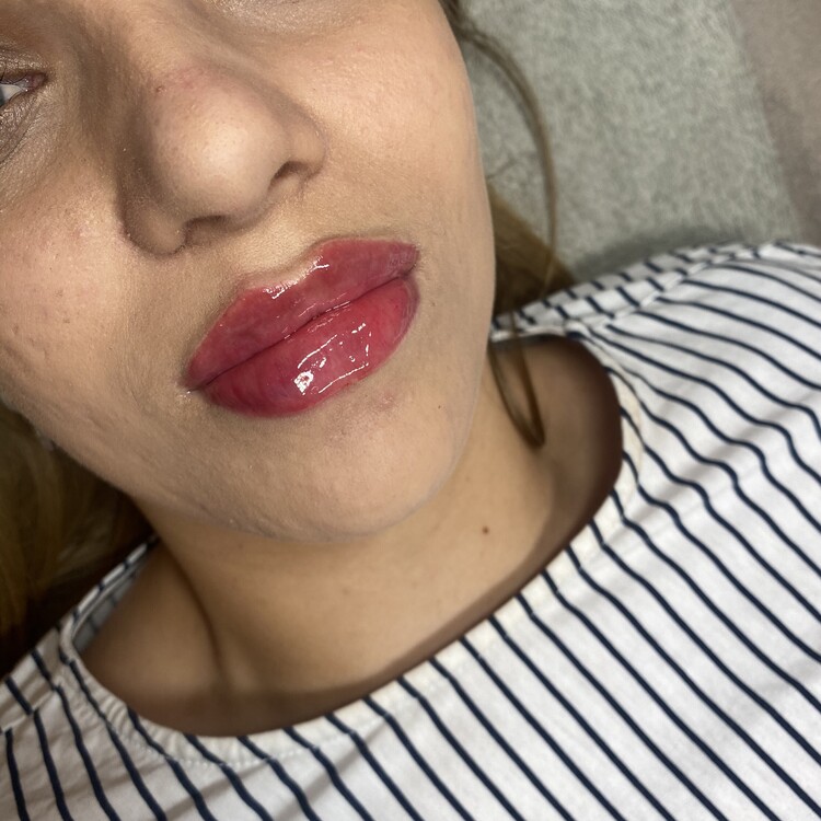 Before & After Results