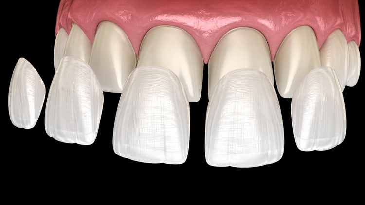 Cosmetic Dentistry | Cramond House Dental Practice | Dentist Clitheroe Preston Manchester | Dental Implants Clitheroe Preston Manchester | Gum Surgery Clitheroe Preston Manchester