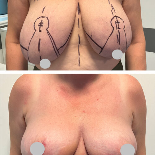 Gallery | FM Plastic Surgery Ltd  | Plastic Surgeon Newcastle | Cosmetic Surgery Newcastle | Skin and Hand Surgery North East