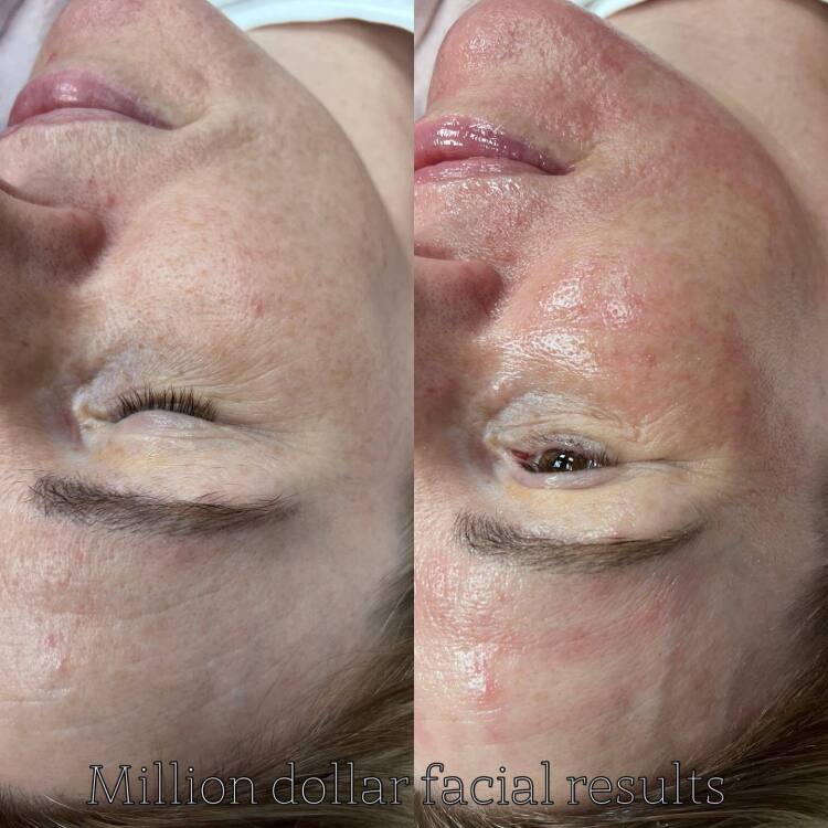 Services | Uber Pigmentations  | Lip blush tattoo ayrshire | Microblading brow tattoo ayrshire | Eyeliner tattoo specialist ayrshire