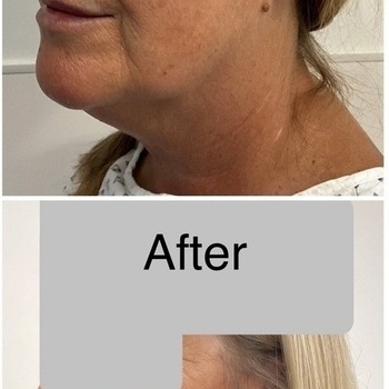 Gallery | FM Plastic Surgery Ltd  | Plastic Surgeon Newcastle | Cosmetic Surgery Newcastle | Skin and Hand Surgery North East