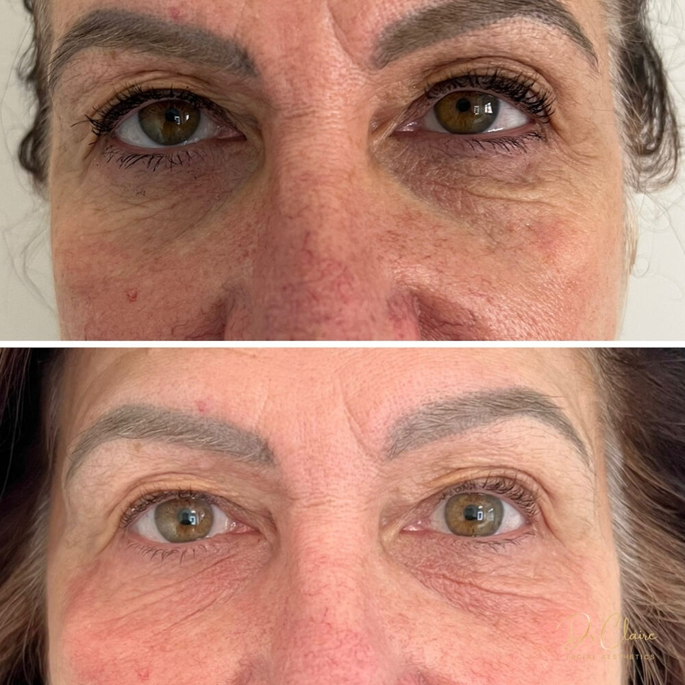 Transformations | Dr Claire Facial Aesthetics | Botox Chorley | Fillers Chorley | Aesthetics Chorley | Botox Treatments Chorley | Dermal Fillers Chorley | Aesthetic Enhancements Chorley