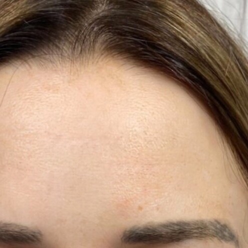 Before & After Results