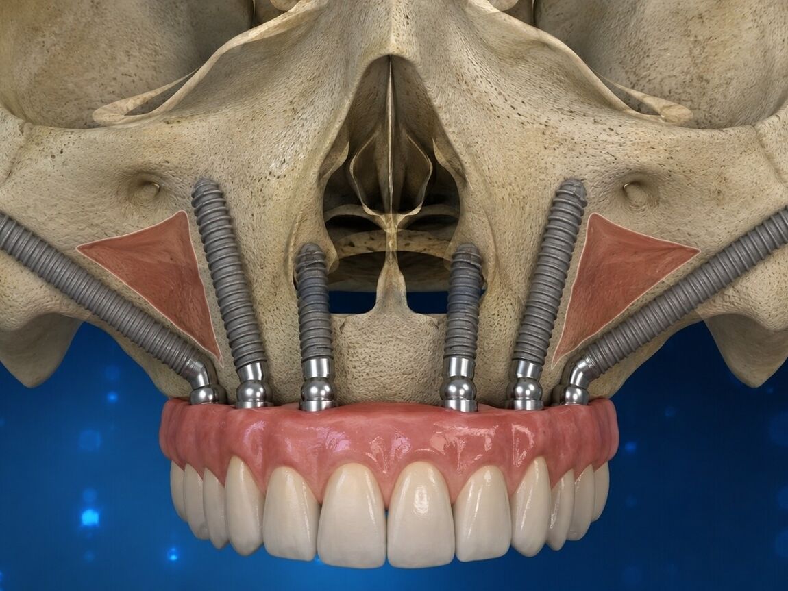 Dental Implants | Cramond House Dental Practice | Dentist Clitheroe Preston Manchester | Dental Implants Clitheroe Preston Manchester | Gum Surgery Clitheroe Preston Manchester