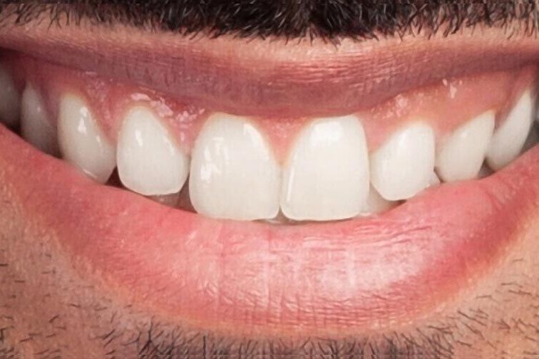 Results | K&amp;S Smiles