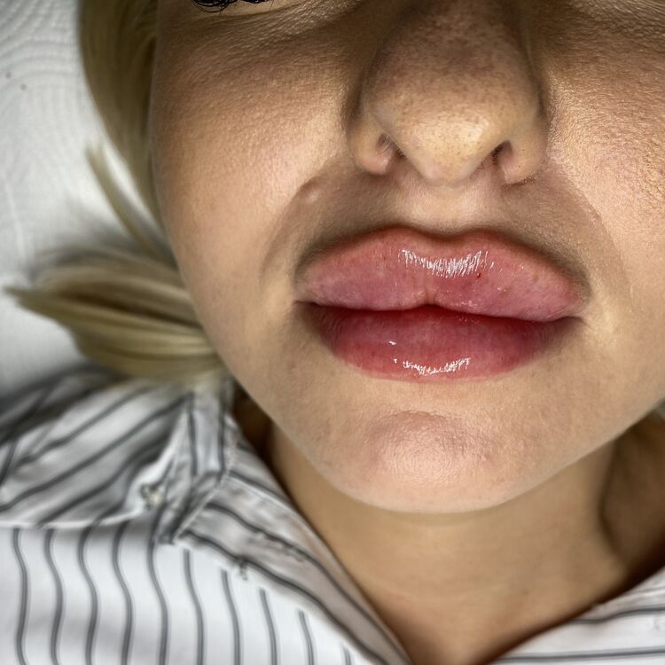 Before & After Results