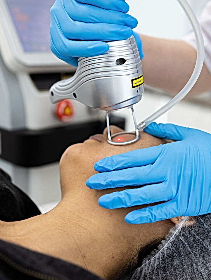 CO2 Fractional Laser 