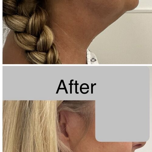 Gallery | FM Plastic Surgery Ltd  | Plastic Surgeon Newcastle | Cosmetic Surgery Newcastle | Skin and Hand Surgery North East