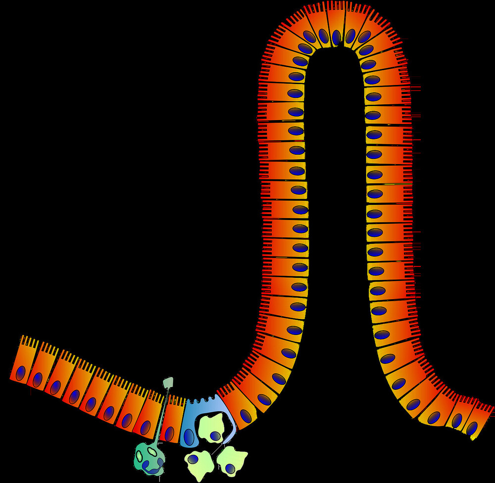 Are You Suffering with Leaky Gut?