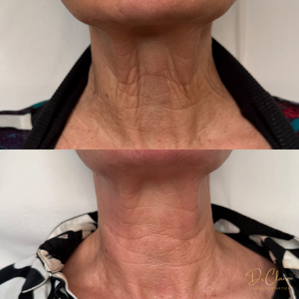 Transformations | Dr Claire Facial Aesthetics | Botox Chorley | Fillers Chorley | Aesthetics Chorley | Botox Treatments Chorley | Dermal Fillers Chorley | Aesthetic Enhancements Chorley