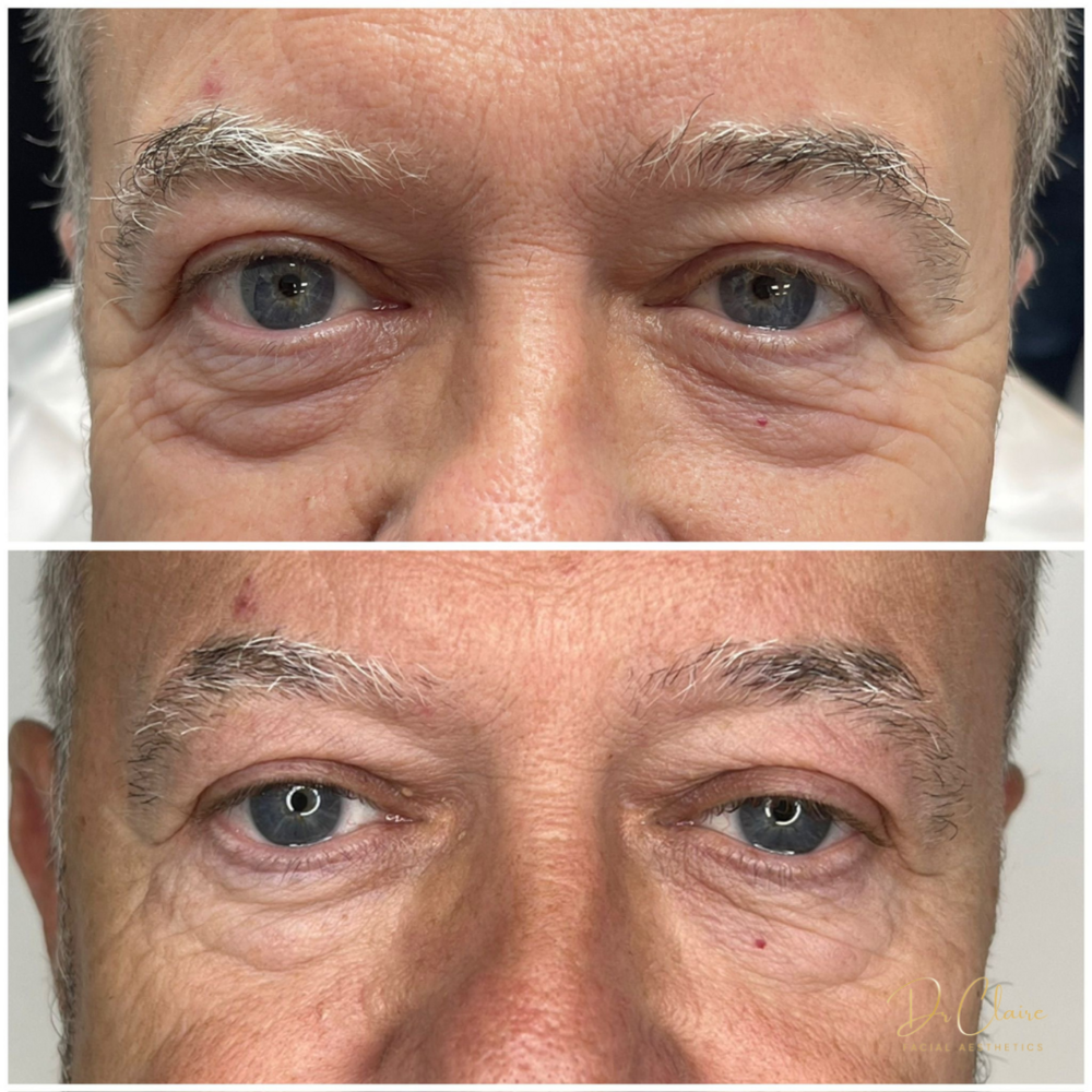 Transformations | Dr Claire Facial Aesthetics | Botox Chorley | Fillers Chorley | Aesthetics Chorley | Botox Treatments Chorley | Dermal Fillers Chorley | Aesthetic Enhancements Chorley