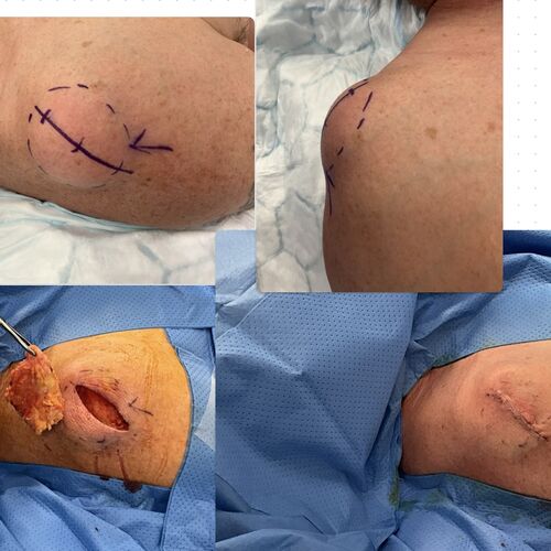 Gallery | FM Plastic Surgery Ltd  | Plastic Surgeon Newcastle | Cosmetic Surgery Newcastle | Skin and Hand Surgery North East