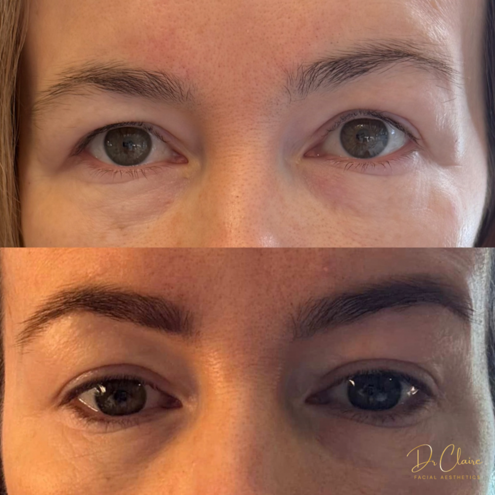 Transformations | Dr Claire Facial Aesthetics | Botox Chorley | Fillers Chorley | Aesthetics Chorley | Botox Treatments Chorley | Dermal Fillers Chorley | Aesthetic Enhancements Chorley