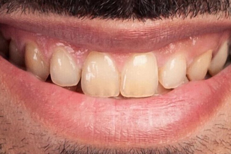 Results | K&amp;S Smiles