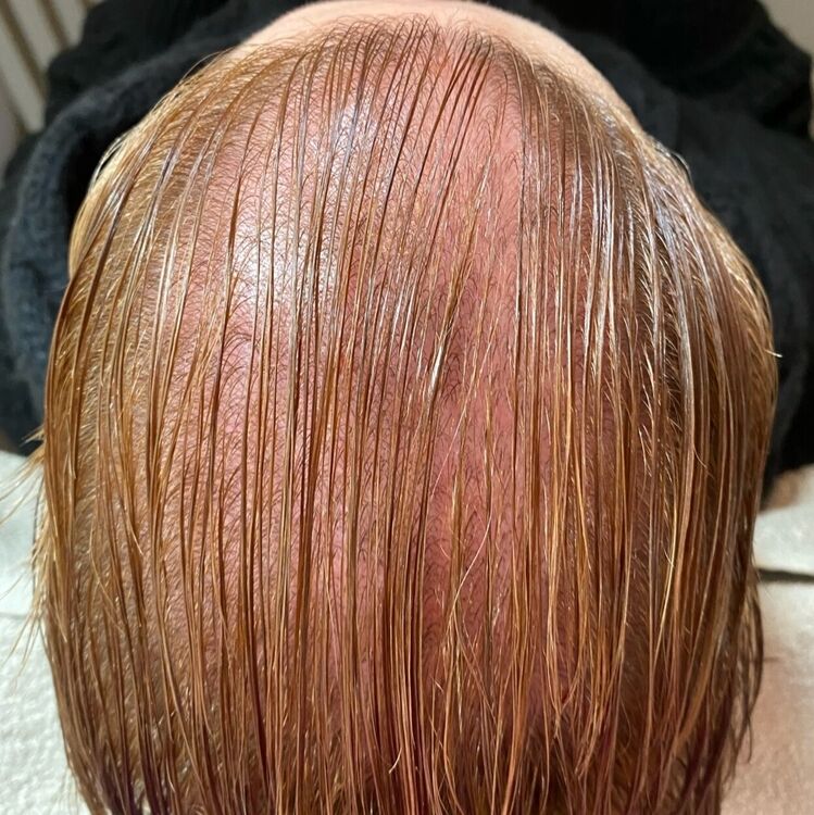 Before & After Results