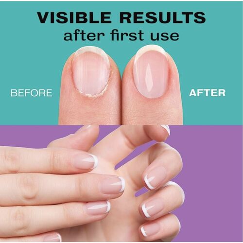 Mylee Nail Treatment Serum - 10ml