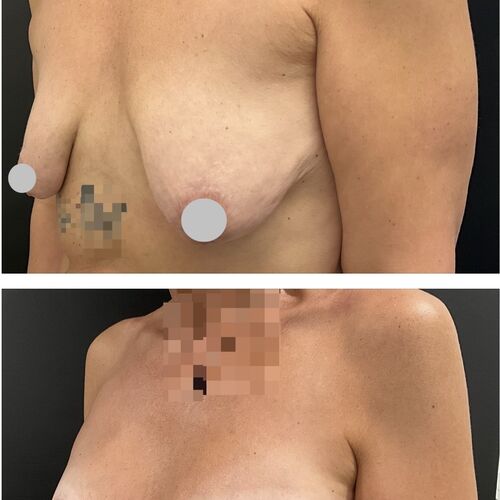 Gallery | FM Plastic Surgery Ltd  | Plastic Surgeon Newcastle | Cosmetic Surgery Newcastle | Skin and Hand Surgery North East