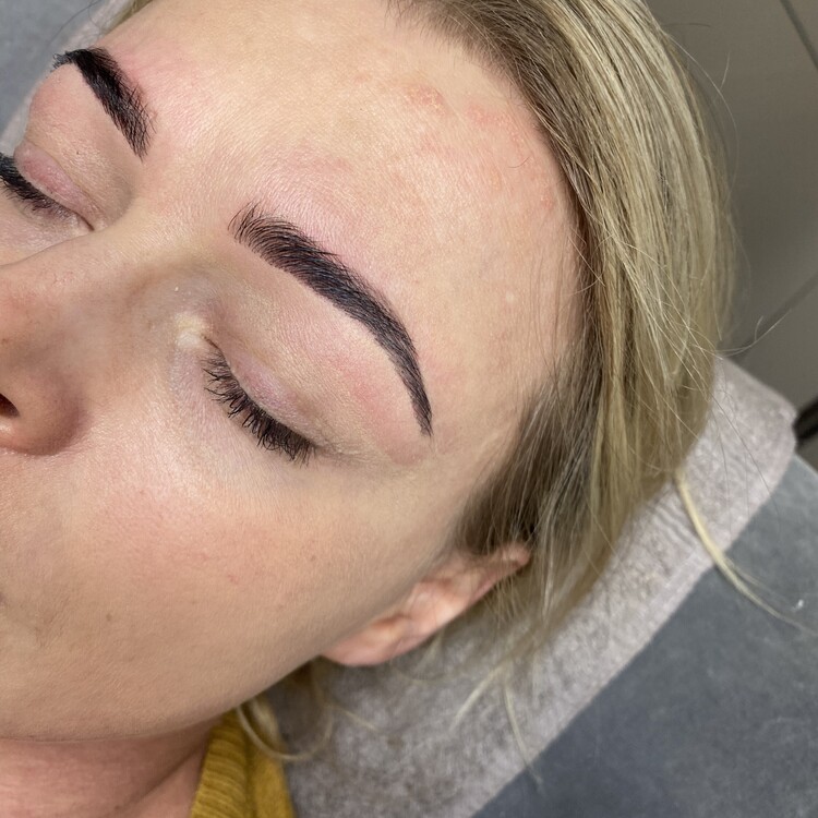 Before & After Results