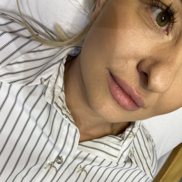 Before & After Results