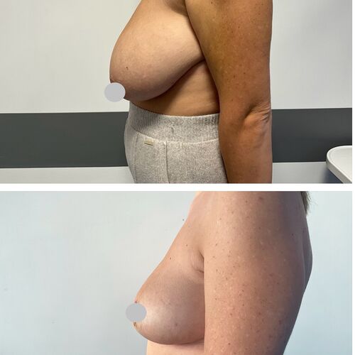 Gallery | FM Plastic Surgery Ltd  | Plastic Surgeon Newcastle | Cosmetic Surgery Newcastle | Skin and Hand Surgery North East