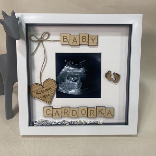 Baby Scan Display Frame