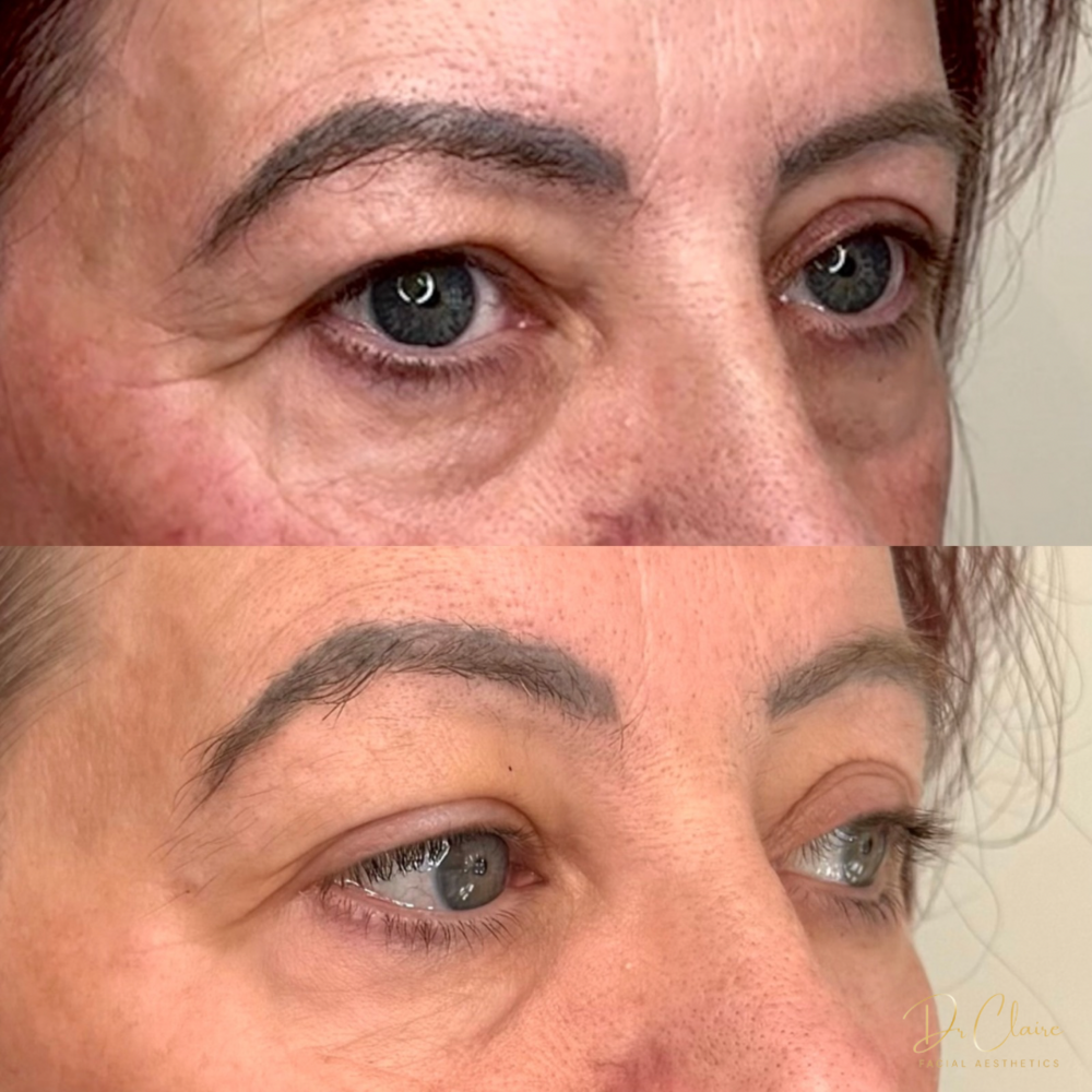 Transformations | Dr Claire Facial Aesthetics | Botox Chorley | Fillers Chorley | Aesthetics Chorley | Botox Treatments Chorley | Dermal Fillers Chorley | Aesthetic Enhancements Chorley