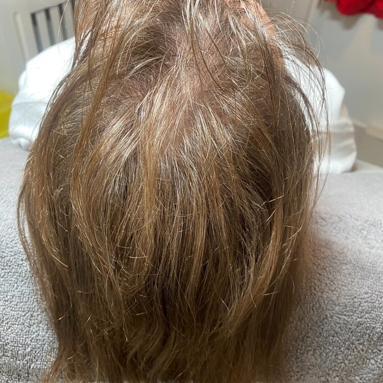 Before & After Results