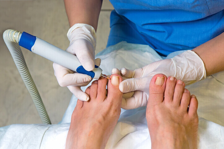 Podiatrist in Glossop | Shire Foot Clinic