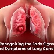 Lung Cancer Awareness