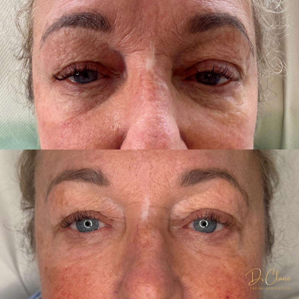 Transformations | Dr Claire Facial Aesthetics | Botox Chorley | Fillers Chorley | Aesthetics Chorley | Botox Treatments Chorley | Dermal Fillers Chorley | Aesthetic Enhancements Chorley