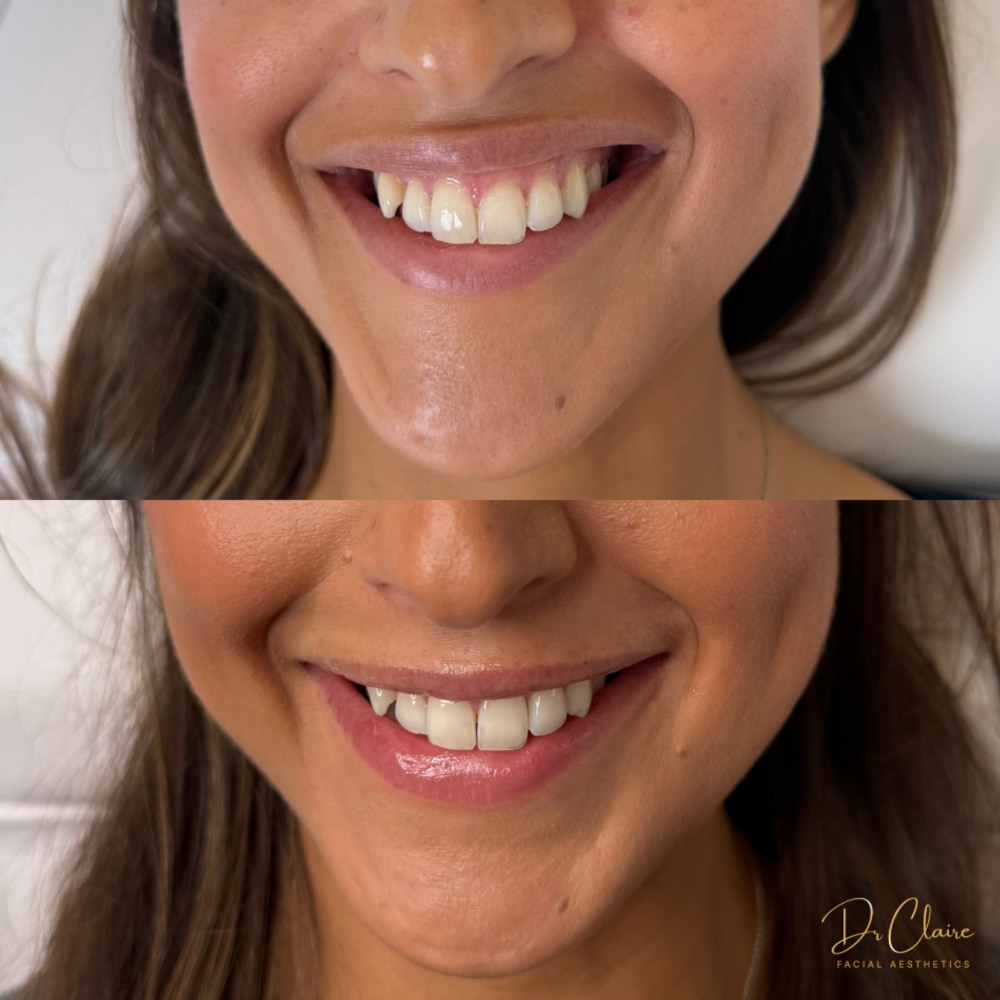 Transformations | Dr Claire Facial Aesthetics | Botox Chorley | Fillers Chorley | Aesthetics Chorley | Botox Treatments Chorley | Dermal Fillers Chorley | Aesthetic Enhancements Chorley