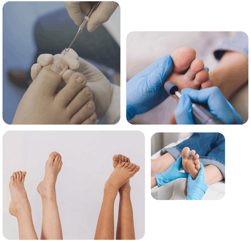 Podiatrist in Glossop | Shire Foot Clinic