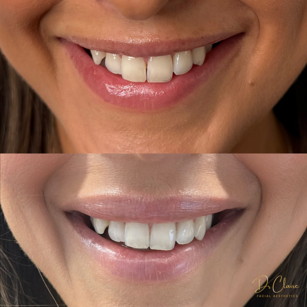 Transformations | Dr Claire Facial Aesthetics | Botox Chorley | Fillers Chorley | Aesthetics Chorley | Botox Treatments Chorley | Dermal Fillers Chorley | Aesthetic Enhancements Chorley