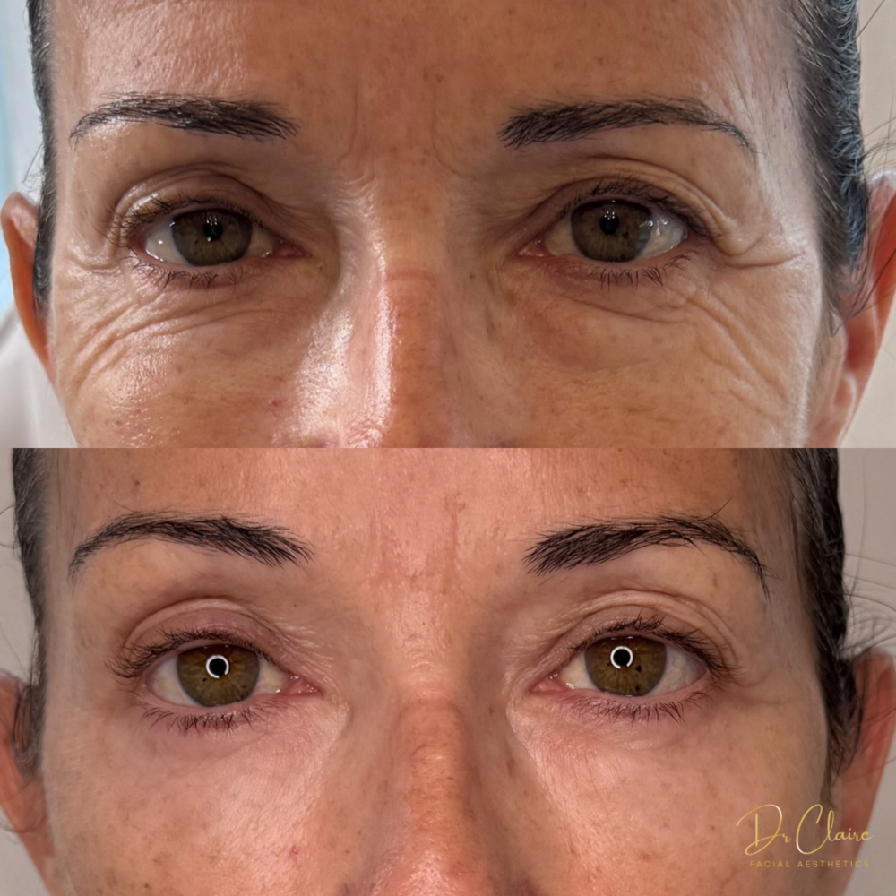 Transformations | Dr Claire Facial Aesthetics | Botox Chorley | Fillers Chorley | Aesthetics Chorley | Botox Treatments Chorley | Dermal Fillers Chorley | Aesthetic Enhancements Chorley