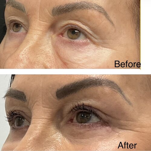 Gallery | FM Plastic Surgery Ltd  | Plastic Surgeon Newcastle | Cosmetic Surgery Newcastle | Skin and Hand Surgery North East