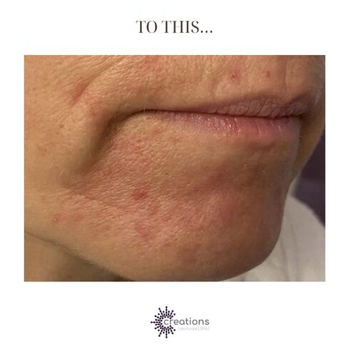 DERMALOGICA SKIN SERVICES | Creations Skincare Centre Ltd | Dermalogica Derby | Elemis Derby | Beauty Salon Mickleover