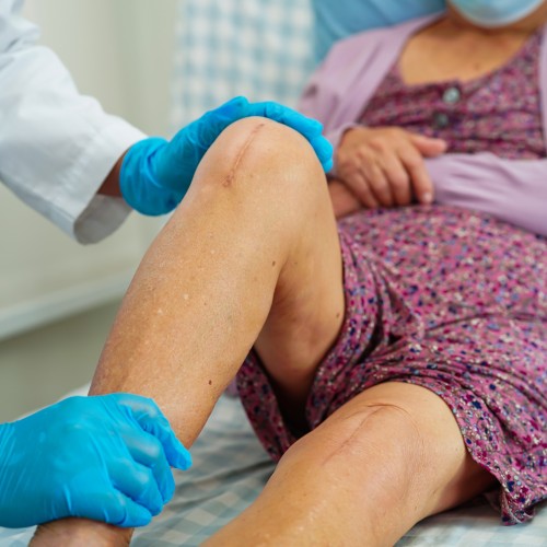 Private Knee Replacements in the UK